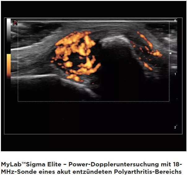 Ultraschallgerät esaote MyLab Sigma Elite BJ 20/21 Demogerät GI, Vasc, DICOM mit 2 Sonden