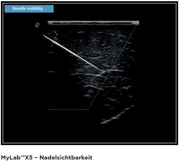 Ultraschallgerät esaote MyLab X5 GI+Kardio mit 3 Sonden