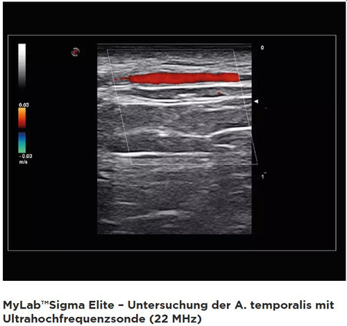 Ultraschallgerät esaote MyLab Sigma Elite BJ 20/21 Demogerät GI, Vasc, DICOM mit 2 Sonden