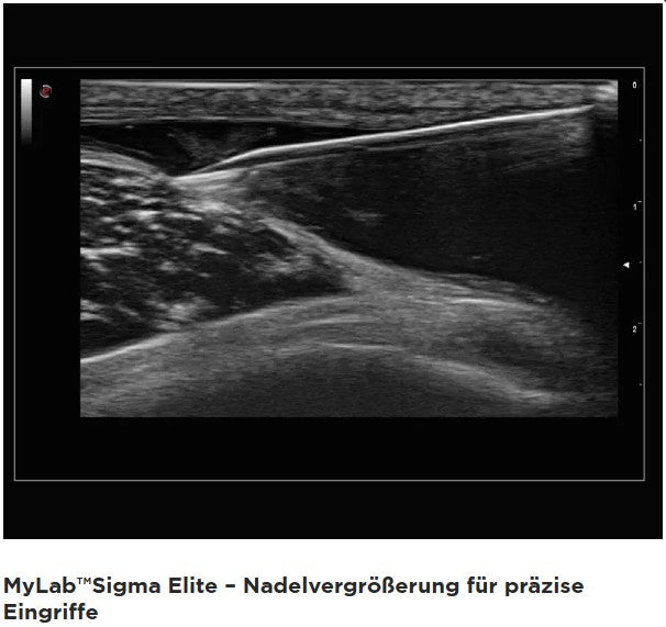 Ultraschallgerät esaote MyLab Sigma Elite BJ 20/21 Demogerät GI, Vasc, DICOM mit 2 Sonden