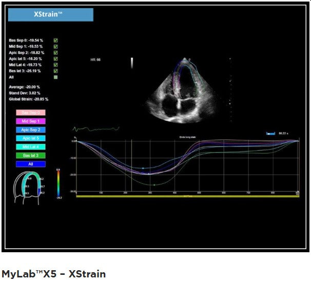 Ultraschallgerät esaote MyLab X5 GI+Kardio mit 3 Sonden