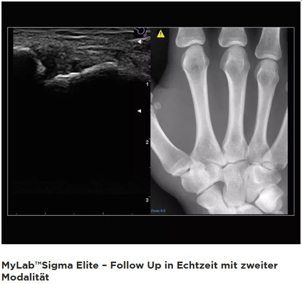 Ultraschallgerät esaote MyLab Sigma Elite BJ 20/21 Demogerät GI, Vasc, DICOM mit 2 Sonden
