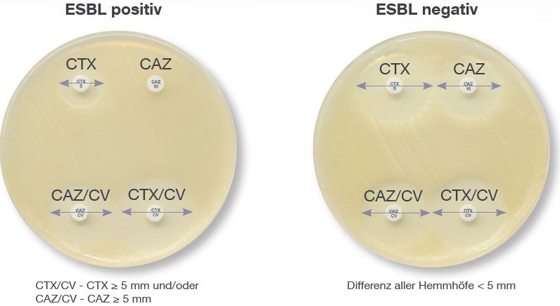 ESBL-Kit D76C (4x 50 Bl., Mast)