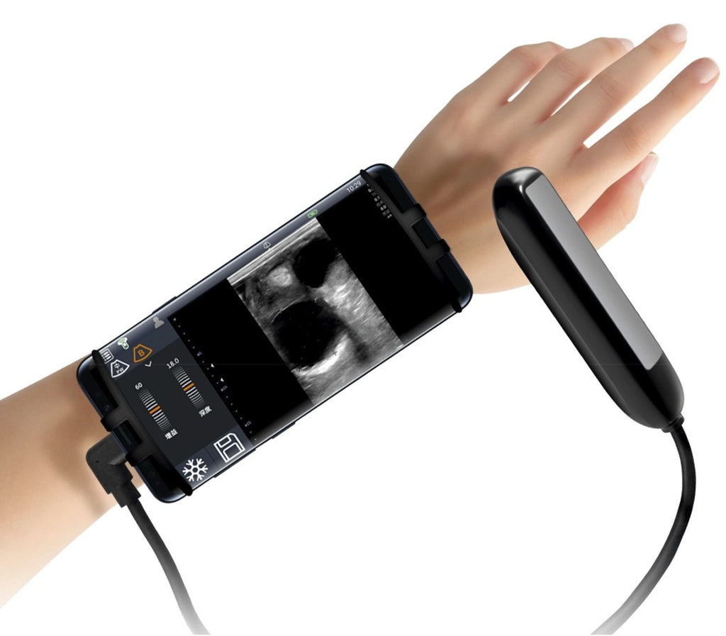 Ultraschallgerät Esaote MyLab™ TringaVET