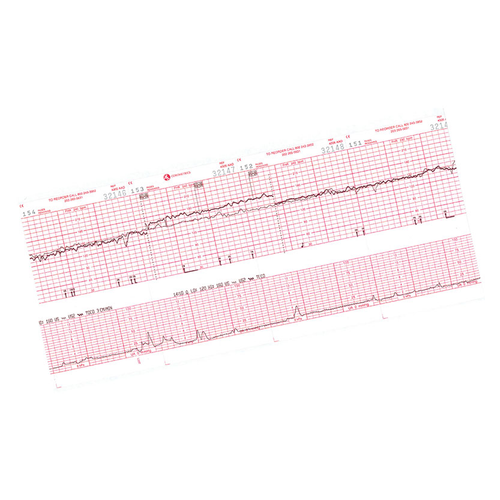 Fetal Chart Paper, 50-120 BPM Sc. (40 Pck)