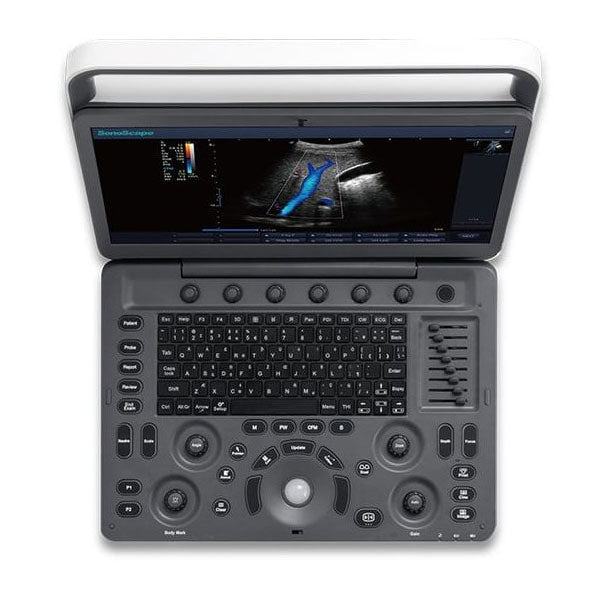 Ultraschallgerät SonoScape E3