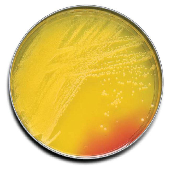 TSA +P80+LRodac-contact Agar - 100 Stk.