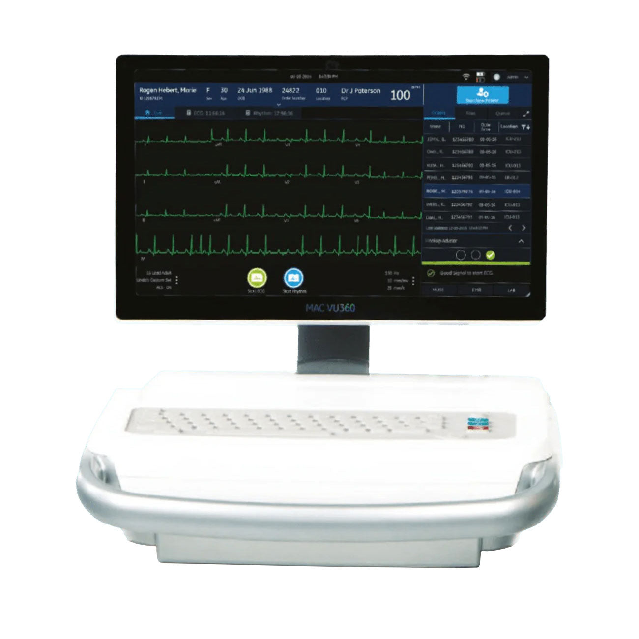 GE MAC VU360 ATO Modell