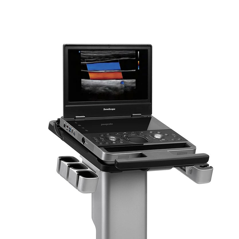 Ultraschallgerät SonoScape E10i Premium Portable Color Doppler
