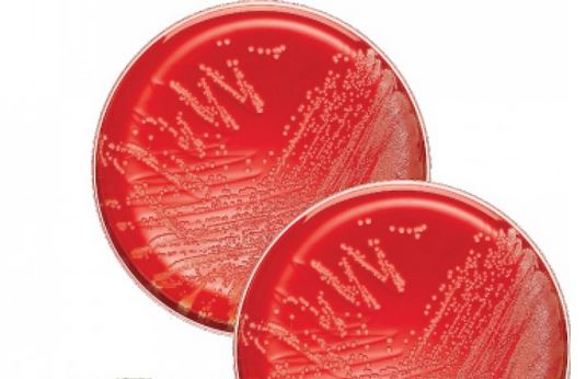 Gardnerella Selektivagar mit 5% Humanblut (20 Pl.)