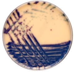 VRE Screening Agar (10 Stck)