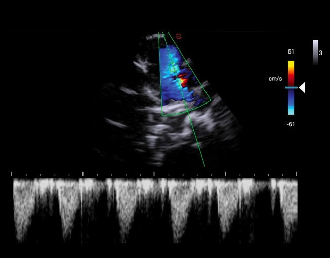 Cardiology Licence zu Esaote MyLab™ X1 Go