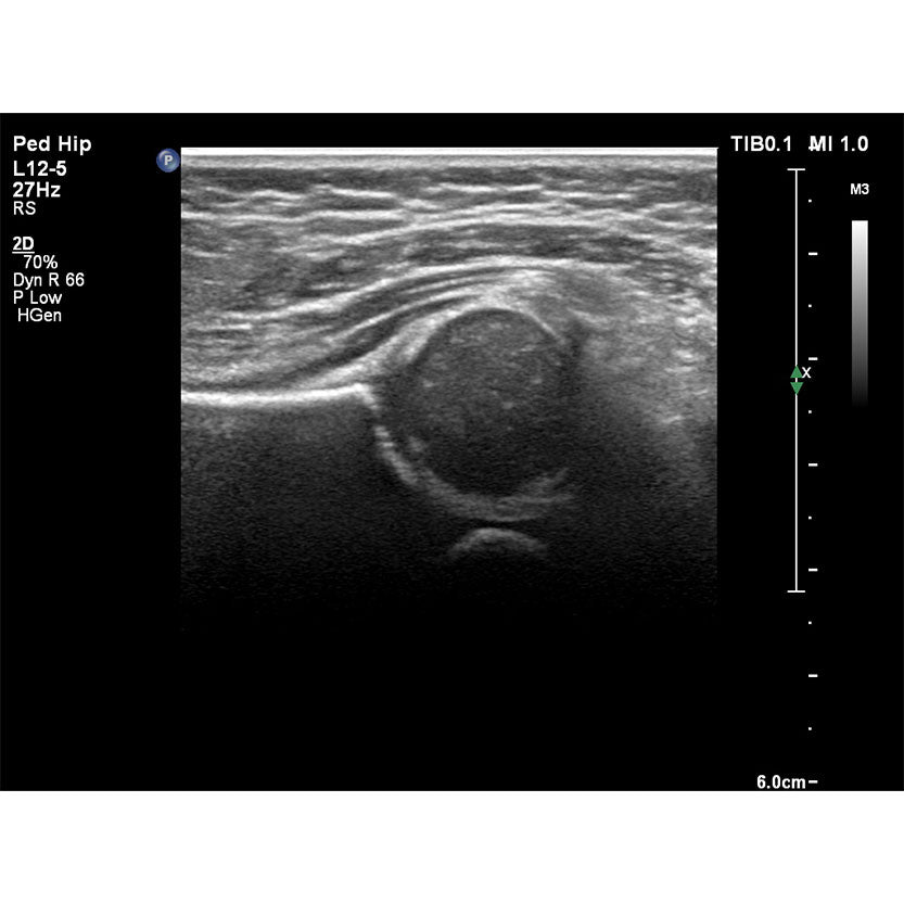 Philips Affiniti 70G Ultrasound System