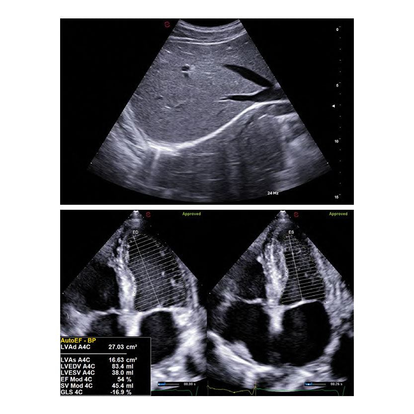 Ultrasound System Esaote MyLab™A50 ETC