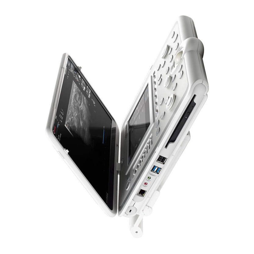 Esaote MyLab™ Omega ultrasound device