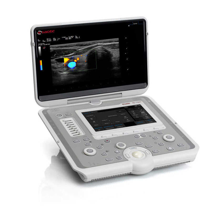 Esaote MyLab™ Sigma Ultrasound System