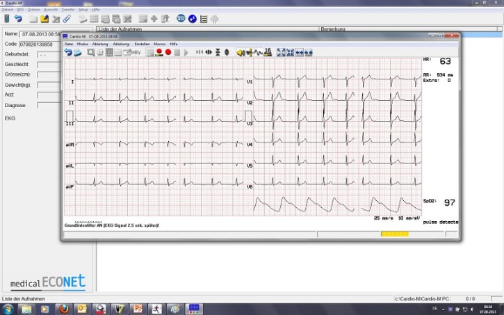 CARDIO M-PC Auswertungssoftware - passend zu allen CARDIO M-PC Versionen