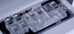 SAA (Serum Amyloid A Protein) Cassettes with Reagent (50 tests)